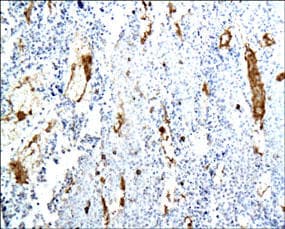 Polyclonal Rabbit anti-Human PECAM-1 / CD31 Antibody (IHC, IF, WB)