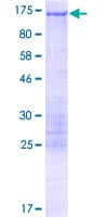 Human CLIP2 / CYLN2 Protein (Recombinant GST)