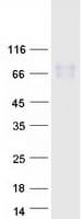 Human CSF2RA / CD116 Protein (Recombinant Myc-DDK (Flag))