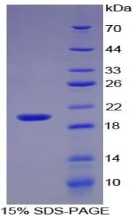 Human IL17 Protein (Recombinant His-T7)