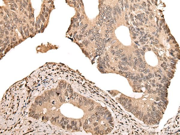 Polyclonal Rabbit anti-Human ZSCAN12 Antibody (IHC)