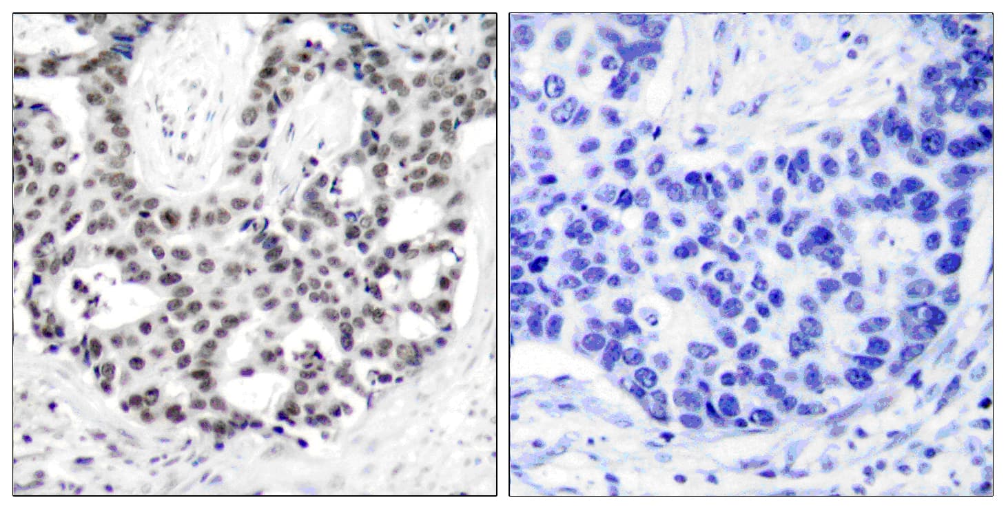 AR / Androgen Receptor Antibody (phospho-Ser650)