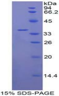 Human IL22 Receptor Protein (Recombinant His-T7)