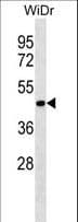 SPFH2 / ERLIN2 Antibody (aa307-333)