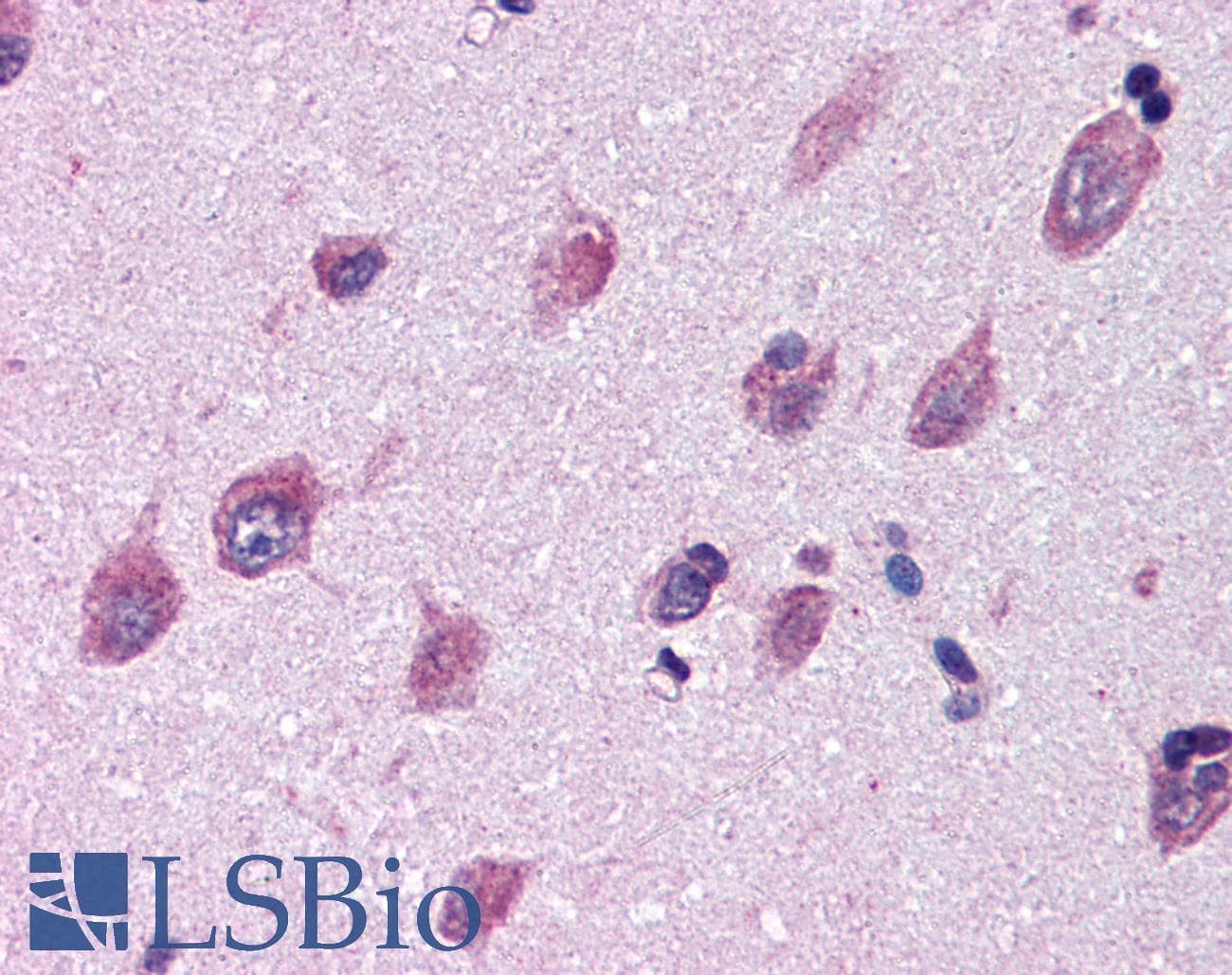 IHC-plus™ CD316 / IGSF8 Antibody (Internal)