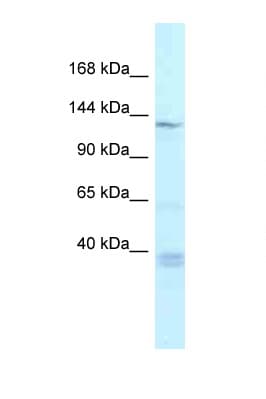 TNKS / Tankyrase Antibody (aa448-497)