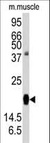 RGS19 Antibody (Ser151)
