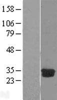 DCK / Deoxycytidine kinase Protein (Over-Expression Lysate Myc-DDK (Flag))