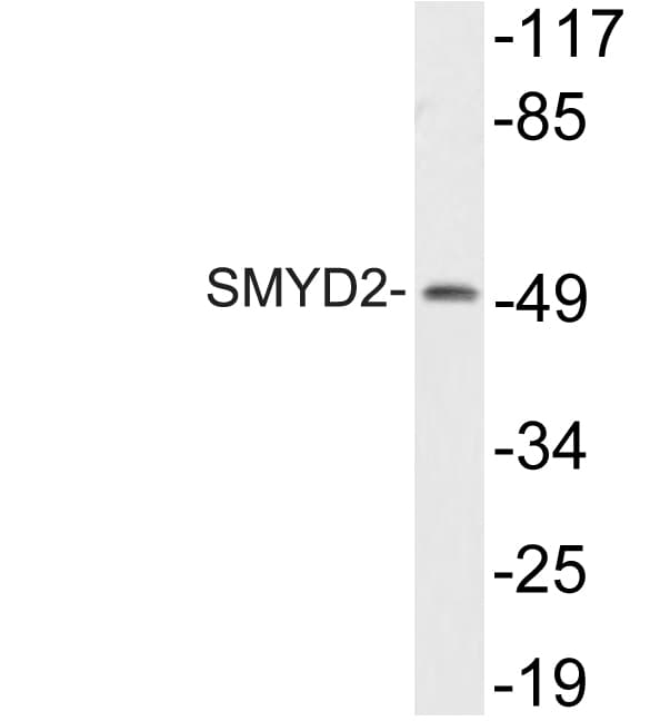 SMYD2 Antibody (aa99-148)