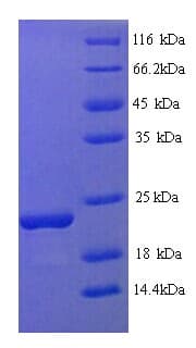 Soybean Gly m 4 Protein (Recombinant His)