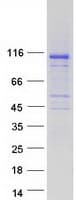 Human INPP4A Protein (Recombinant Myc-DDK (Flag))
