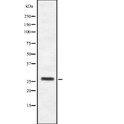 Polyclonal Rabbit anti-Human HOXB4 Antibody (WB)