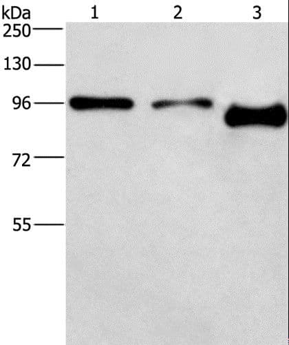 Polyclonal Rabbit anti-Human PIP5K1C Antibody (WB)