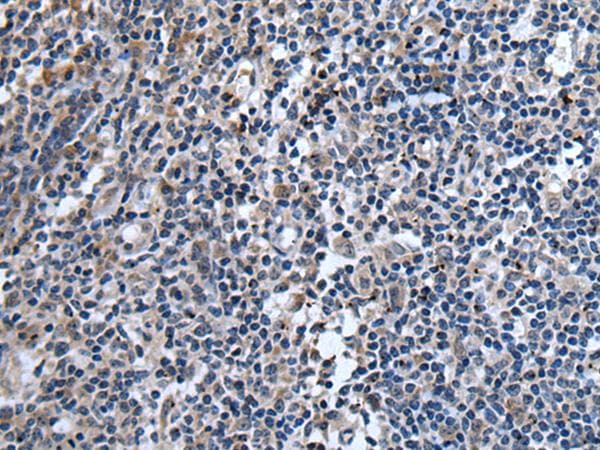 Polyclonal Rabbit anti-Human TNFSF18 / GITRL Antibody (IHC)