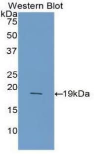 I-FABP / FABP2 Antibody (aa2-132, Biotin)