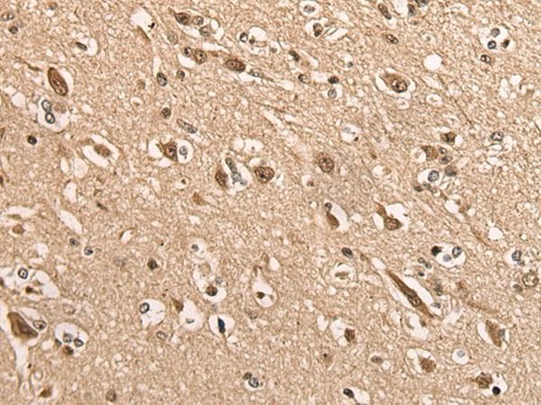 BATF Antibody