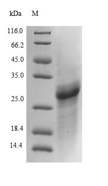 Mouse COL4A2 / Collagen IV Alpha2 Protein (Recombinant 6His, N-terminus)