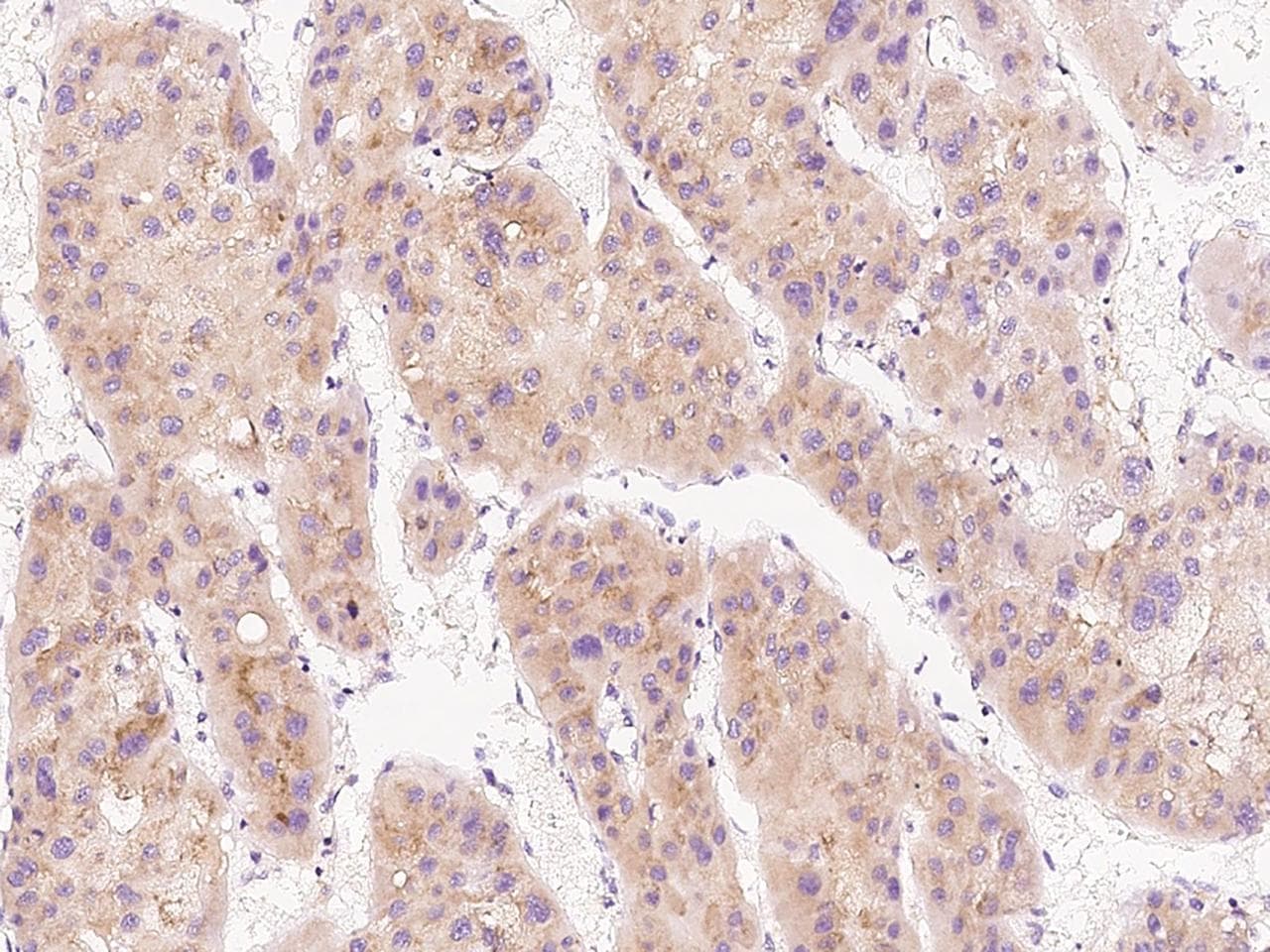 FETUB / Fetuin B Antibody