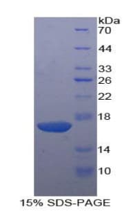 Human KLRB1 / CD161 Protein (Recombinant His-T7)