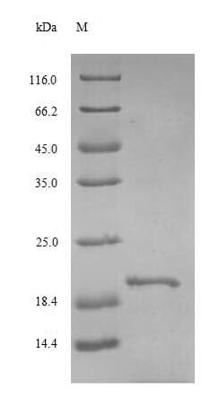 Rat TSHB / TSH-Beta Protein (Recombinant 10His, N-terminus + Myc, C-terminus)