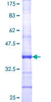 Human CD6 Protein (Recombinant GST, N-terminus)