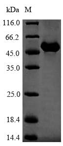 Mouse GC / Vitamin D-Binding Protein (Recombinant 6His, N-terminus)
