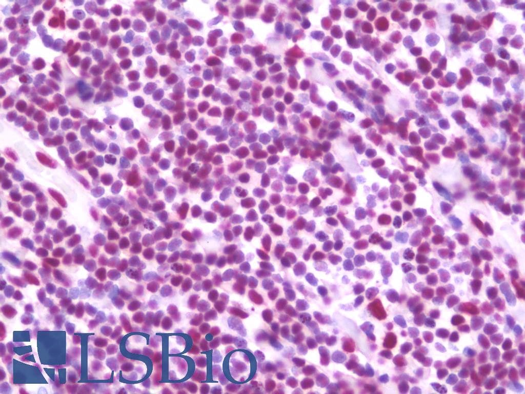 IHC-plus™ TRIM28 / KAP1 Antibody