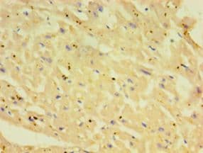 YKL39 / CHI3L2 Antibody