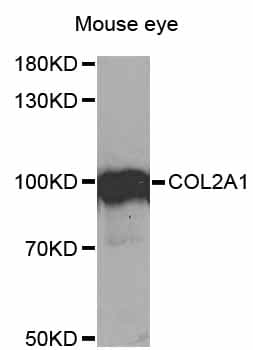 Polyclonal Rabbit anti-Human COL2A1 / Collagen II Alpha 1 Antibody (WB)