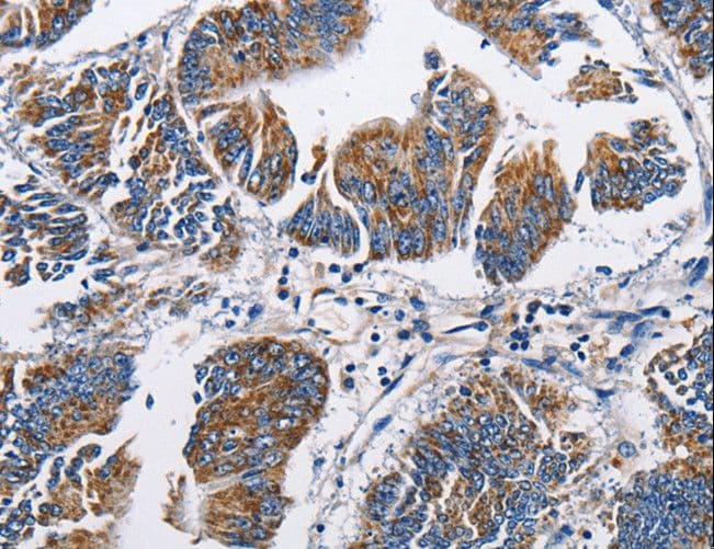 Polyclonal Rabbit anti-Human NPPA / ANP Antibody (IHC)