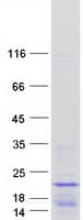 Human HIST1H2BB Protein (Recombinant Myc-DDK (Flag))