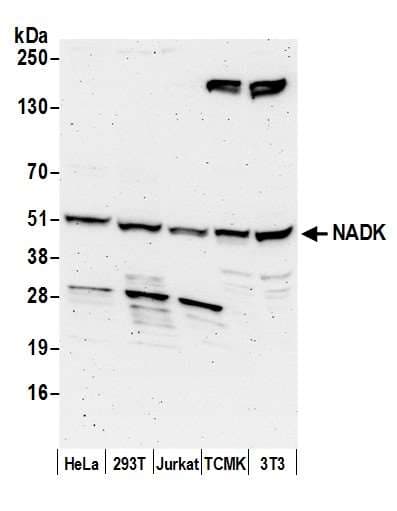 Polyclonal Rabbit anti-Human NADK / NAD Kinase Antibody (aa25-75, WB)