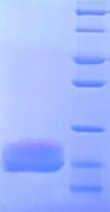 E. coli LptA Protein (Recombinant His)