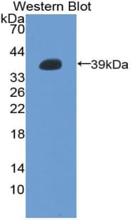 Metallothionein 2 Antibody (aa1-61, PE)