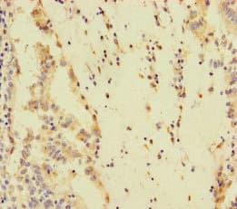 Polyclonal Rabbit anti-Human SPEM1 Antibody