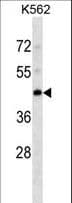 Monoclonal Mouse anti-Human PDK4 Antibody (WB)