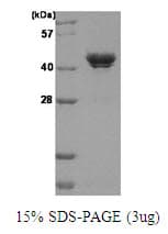Human CSNK2A1 Protein (Recombinant His)