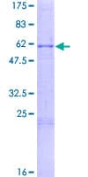 Human POMC / Proopiomelanocortin Protein (Recombinant GST)