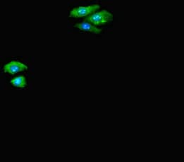 Polyclonal Rabbit anti-Human CTNND2 / Delta-2 Catenin Antibody (aa4-308, IHC, IF)