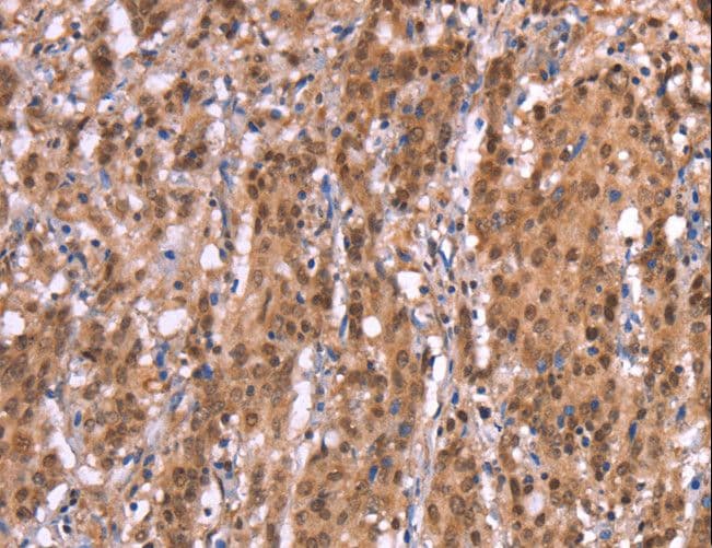 FAM123B / WTX Antibody