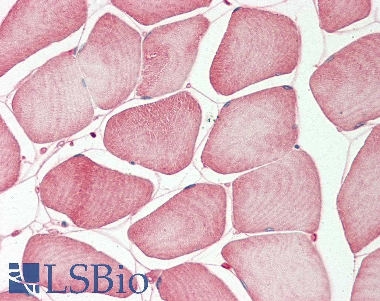 TMPRSS3 Antibody (N-Terminus)