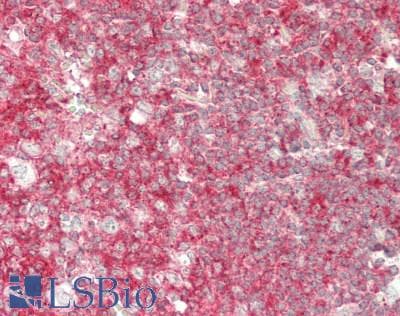 IHC-plus™ IL5 Antibody (aa43-92)