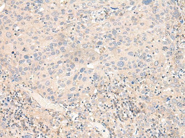 Polyclonal Rabbit anti-Human KCNA10 Antibody (IHC)