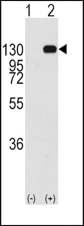 FGFR1 / FGF Receptor 1 Antibody (Tyr463)