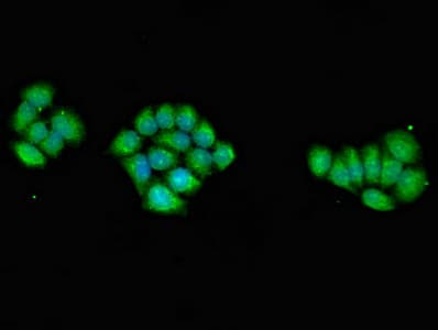 PRKAG1 / AMPK Gamma 1 Antibody