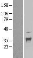 DNAJC17 Protein (Over-Expression Lysate Myc-DDK (Flag))