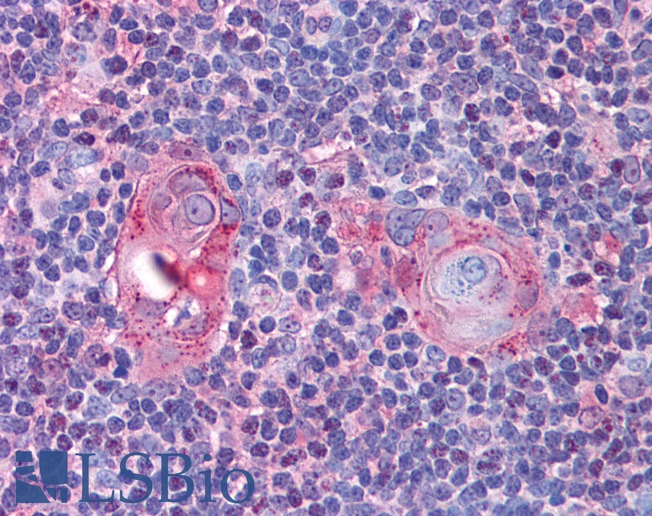 IHC-plus™ CASP7 / Caspase 7 Antibody