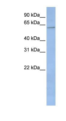 CYP2C19 Antibody (aa324-373)