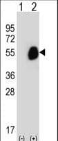GCD / GCDH Antibody (aa336-365)