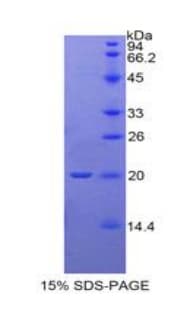 Mouse THPO / TPO / Thrombopoietin Protein (Recombinant His, N-Terminal)